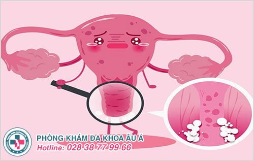 Tất tần tật những kiến thức mà chị em nên biết về bệnh phụ khoa