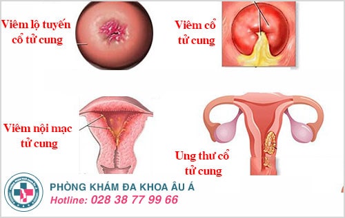 khí hư đặc