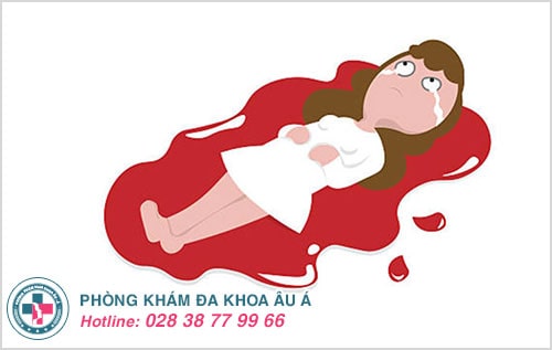 Kinh nguyệt ra nhiều: nguyên nhân và cách điều trị hiệu quả