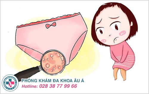Quan hệ bị ngứa, tưởng nhẹ mà không hề nhẹ