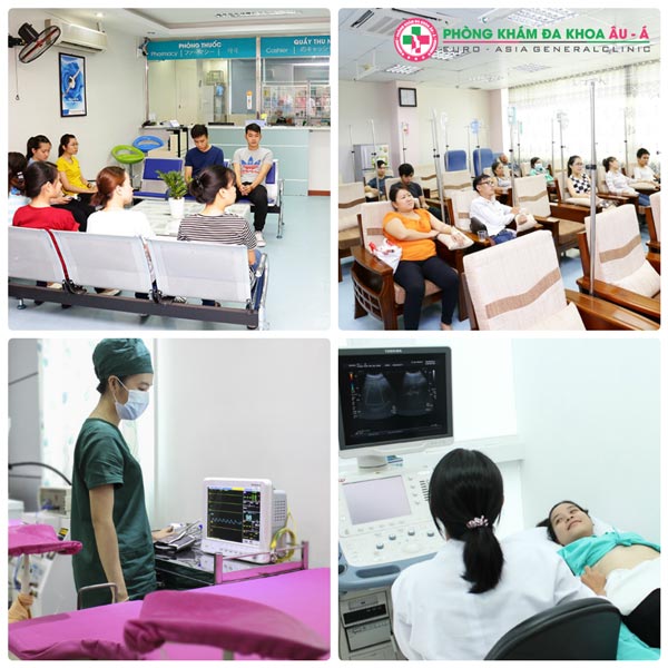 Phương pháp phá thai 6 tuần trong thời gian cho con bú