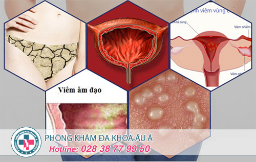 Đau rát âm đạo ở nữ giới có nguy hiểm?