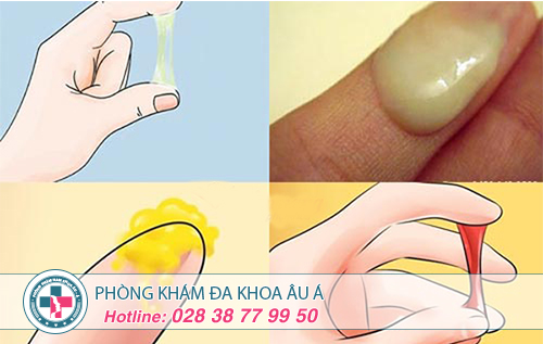 Địa Chỉ Chữa Khí Hư Bất Thường Tốt  Tại TP. HCM