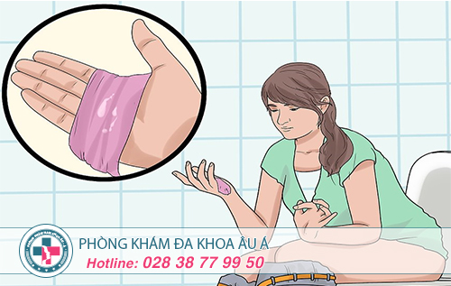 Khí Hư Đặc Quánh Là Biểu Hiện Của Bệnh Gì?