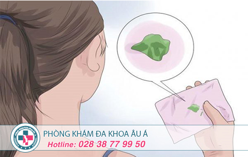 Khí Hư Màu Xanh Là Biểu Hiện Của Bệnh Gì?