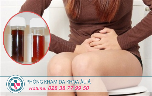 Nguy Hại Và Phương Pháp Hỗ Trợ Điều Trị Tiểu Buốt, Tiểu Ra Máu Ở Nữ Giới