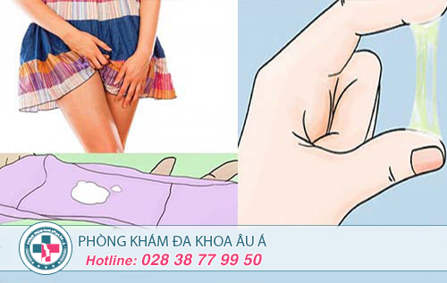 Phương Pháp Hỗ Trợ Điều Trị Khí Hư Bất Thường Hiệu Qủa