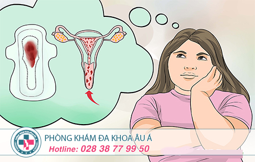 Thế nào là kinh nguyệt không đều?